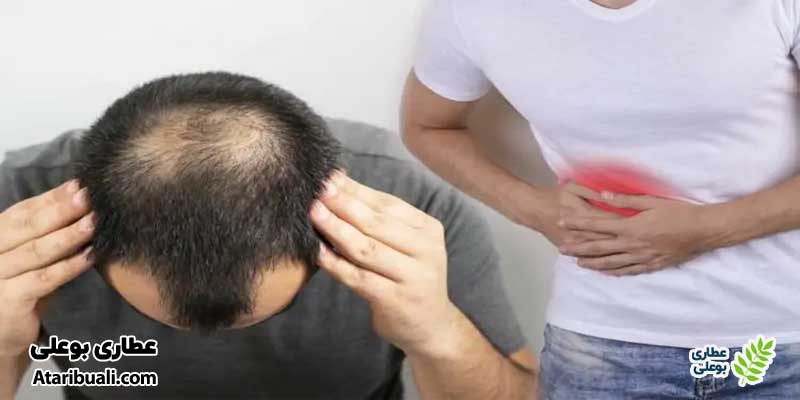 رابطه کبد چرب و ریزش مو