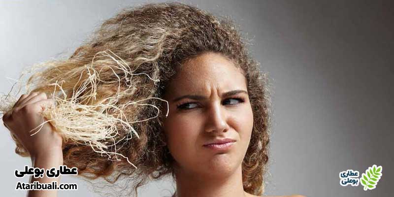 علائم سودا در مغز