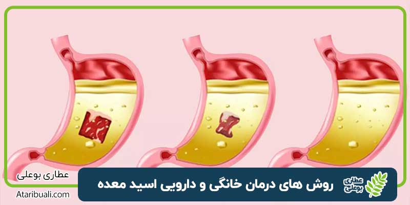 اسید معده