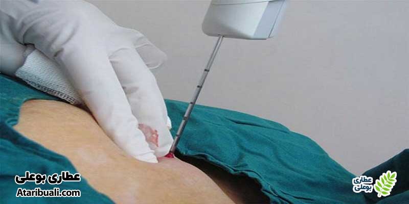احساسات و نکات قابل انتظار در طول بیوپسی