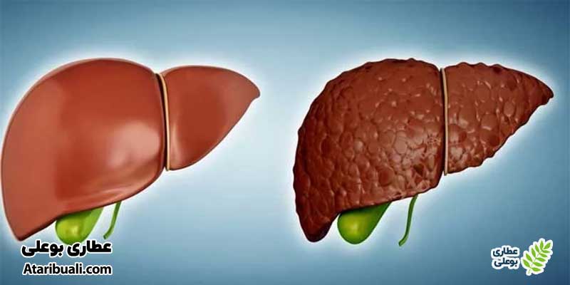 خواص چهار تخمه برای کبد چرب