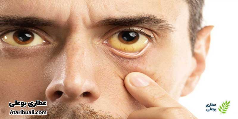 علائم مرتبط با متاستاز سرطان معده