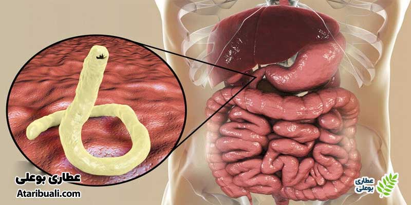علت عفونت معده چیست؟
