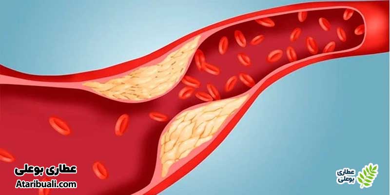 خواص قرص لیورگل، کاهش چربی خون