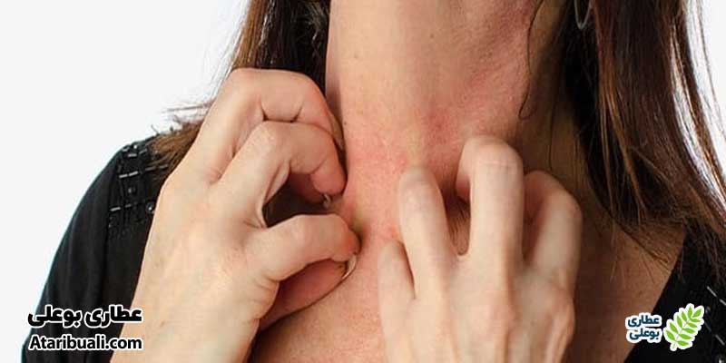 واکنش‌های آلرژیک