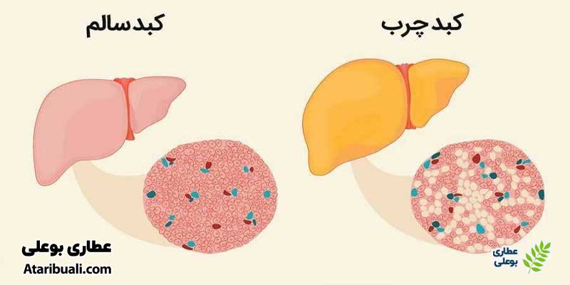 خواص قرص سینارکول دینه، بهبود کبد چرب