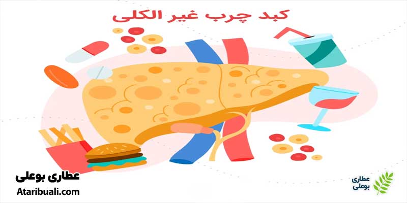 خواص قرص میلک تیستل: درمان کبد چرب غیرالکلی