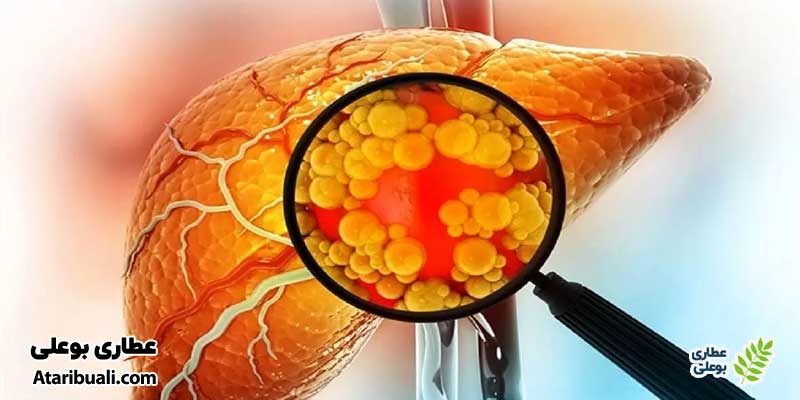 خواص کپسول لیورکینگ بی دی آ، مؤثر در بهبود کبد چرب