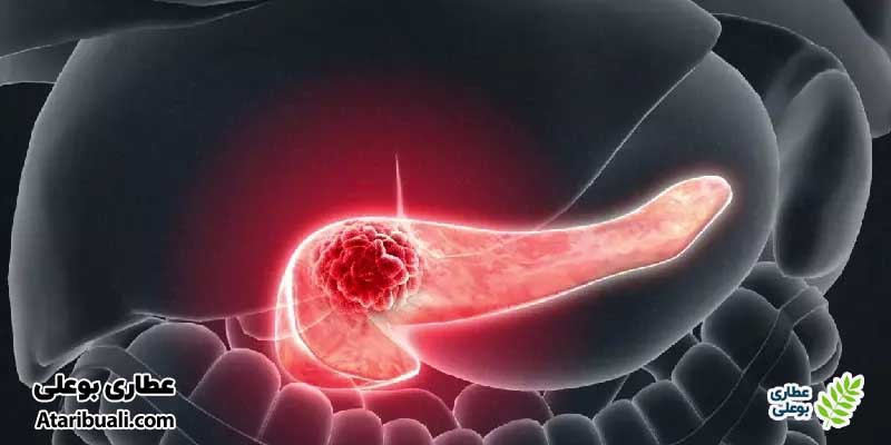 خواص کپسول ویت ایس، کاهش ریسک ابتلا به سرطان کبد و پانکراس