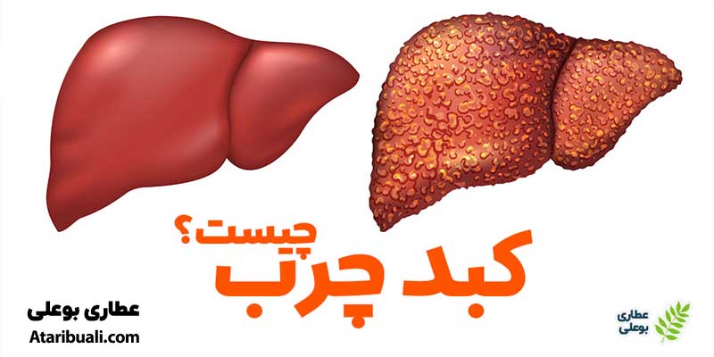 کبد چرب چیست؟