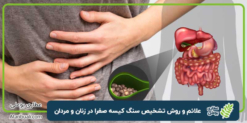علائم و روش تشخیص سنگ کیسه صفرا در زنان و مردان و درمان
