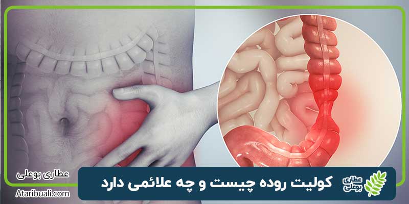 کولیت روده چیست و چه علائمی دارد + برای درمان کولیت روده چی بخوریم