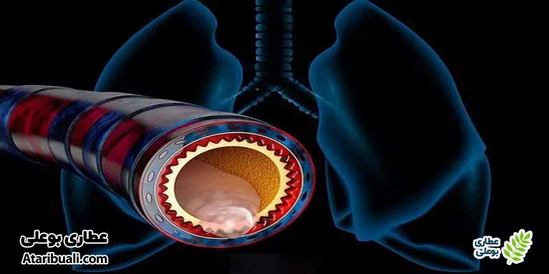 خواص کپسول آماتیور، رقیق کنندگی خلط و مورد استفاده در برونشیت