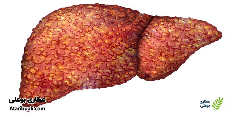 خواص کپسول لیور آکس، برطرف‌کننده سیروز کبدی