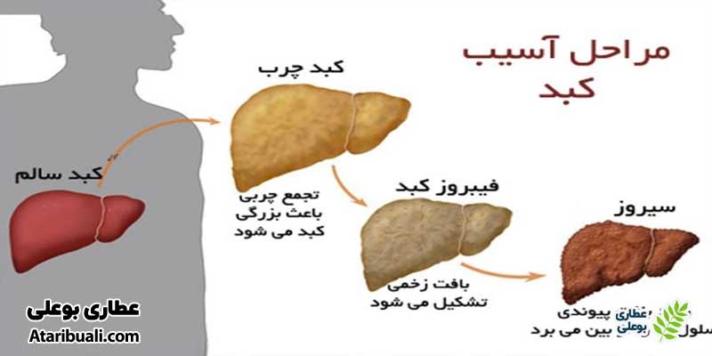 خواص کپسول لیور وید، درمان انواع بیماری‌های آسیب کبدی