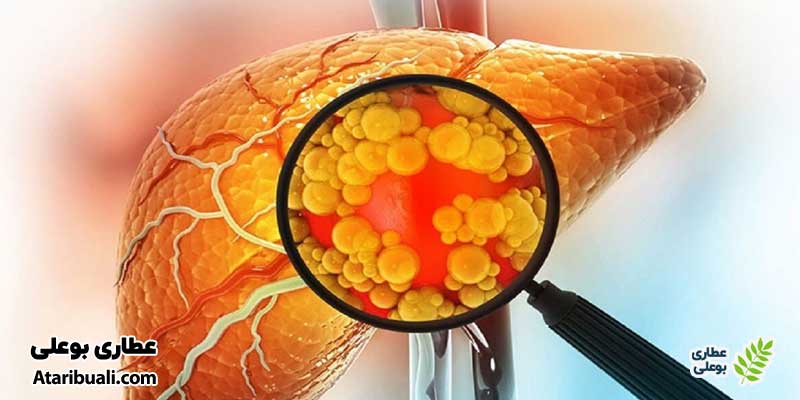 خواص کپسول لیوسل آنتی ایجینگ، ممانعت از تجمع و رسوب چربی‌ها در کبد