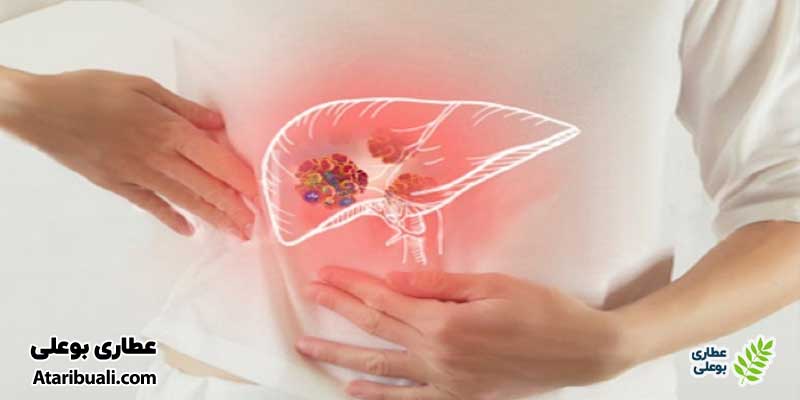 خواص کپسول نوتری دکتر اهورا، درمان التهابات کبدی