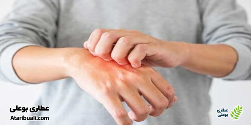 عوارض کپسول نوتری دکتر اهورا