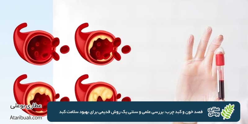 Blood Clotting and Fatty Liver