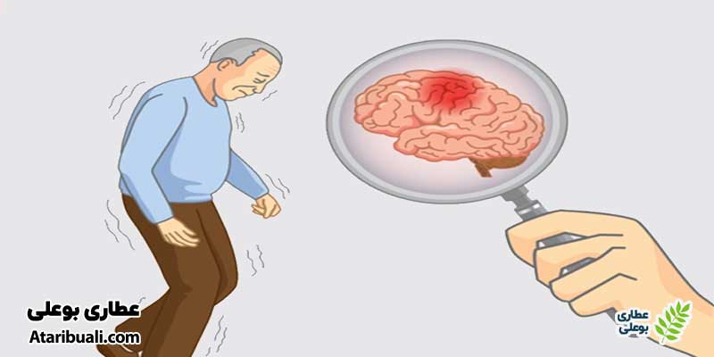 بهبود عملکرد مغز و پیشگیری از آلزایمر