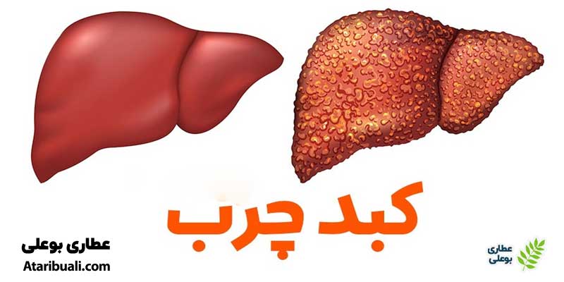 پیشگیری از تجمع چربی و بیماری‌های کبدی