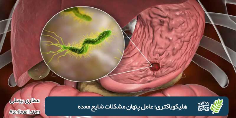 Helicobacter pylori
