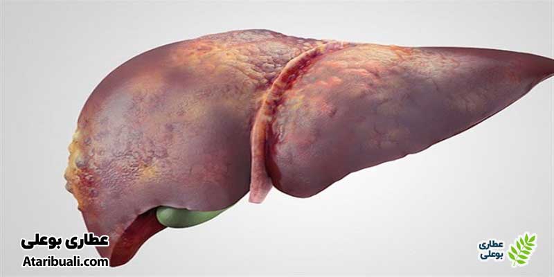علل احتمالی افزایش آنزیمهای کبدی