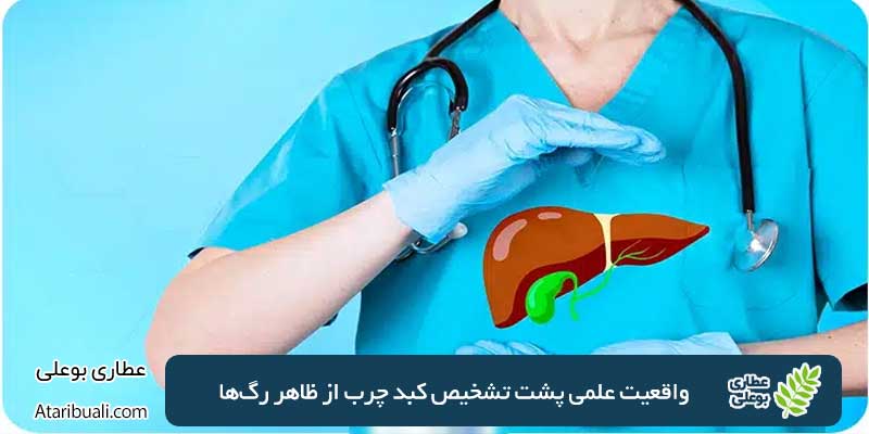 The scientific truth behind diagnosing fatty liver from the appearance of veins