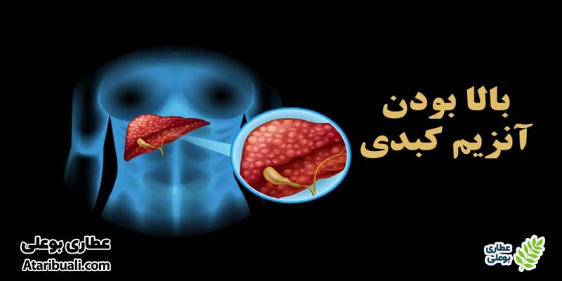 بالا بودن آنزیمهای کبدی چه معنایی دارد؟