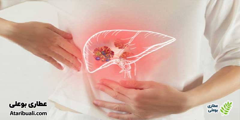 تأثیر خرما بر سلامت کبد چرب