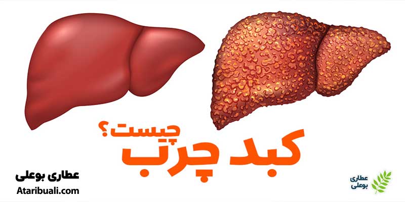 کبد چرب چیست؟